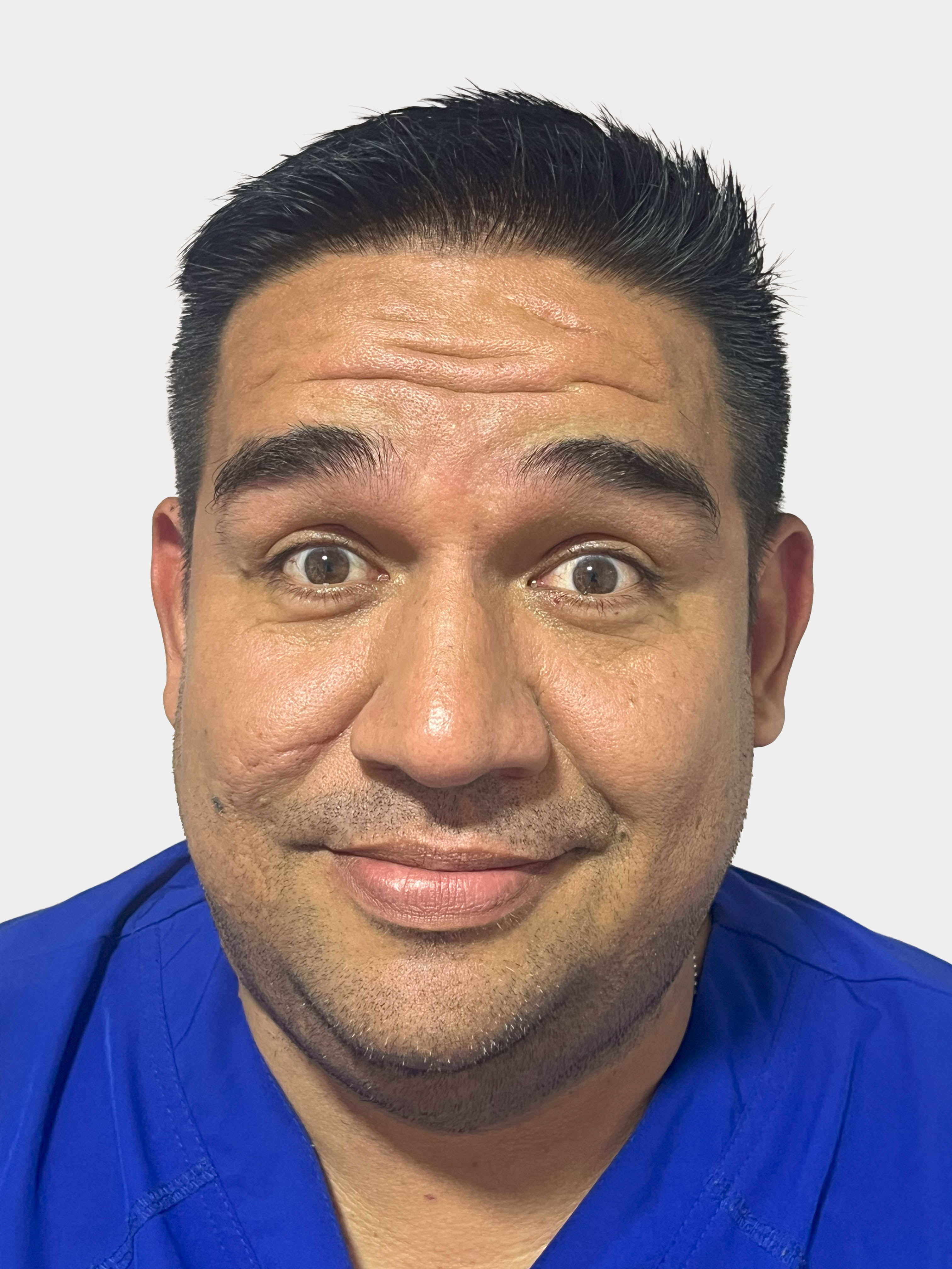 Antes de Toxina Botulínica